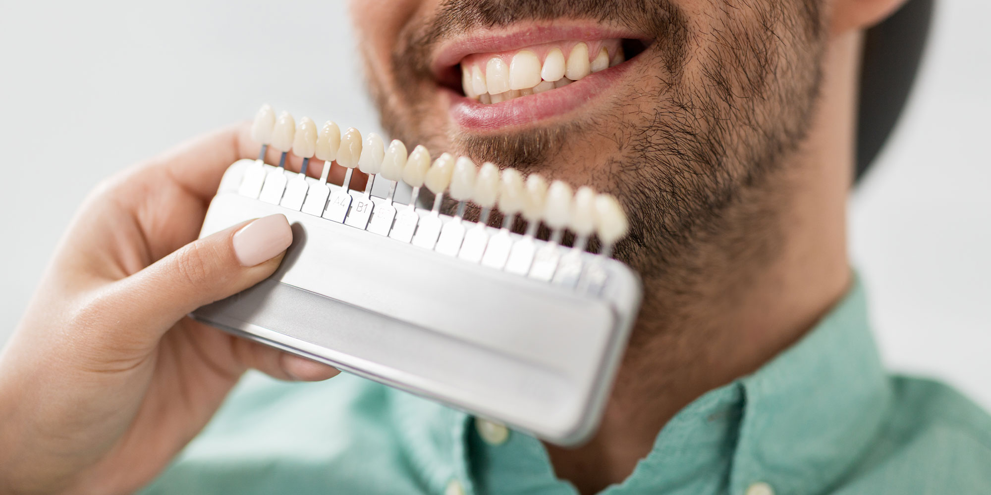 person smiling showing veneers